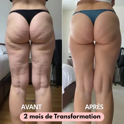 Leggings 3D-Anti-Cellulite skinnyGlow