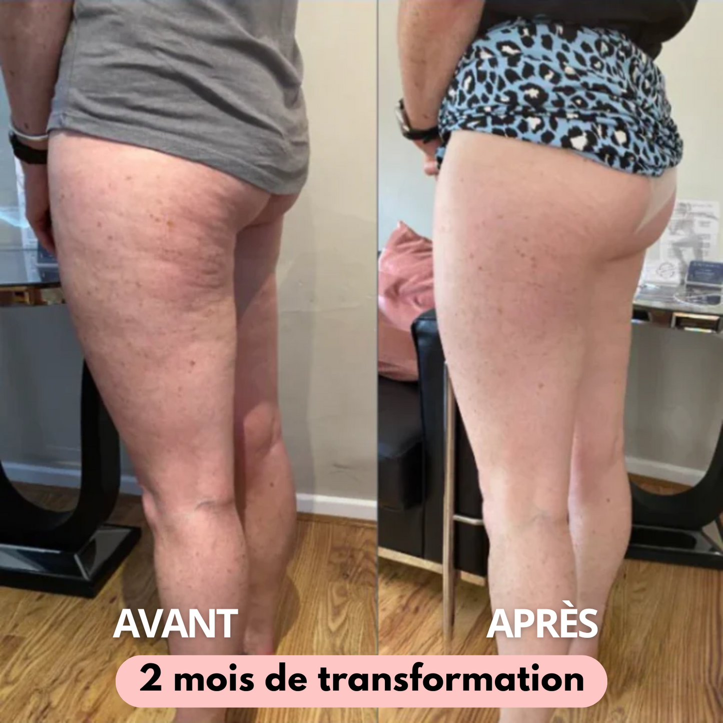 Leggings 3D-Anti-Cellulite skinnyGlow