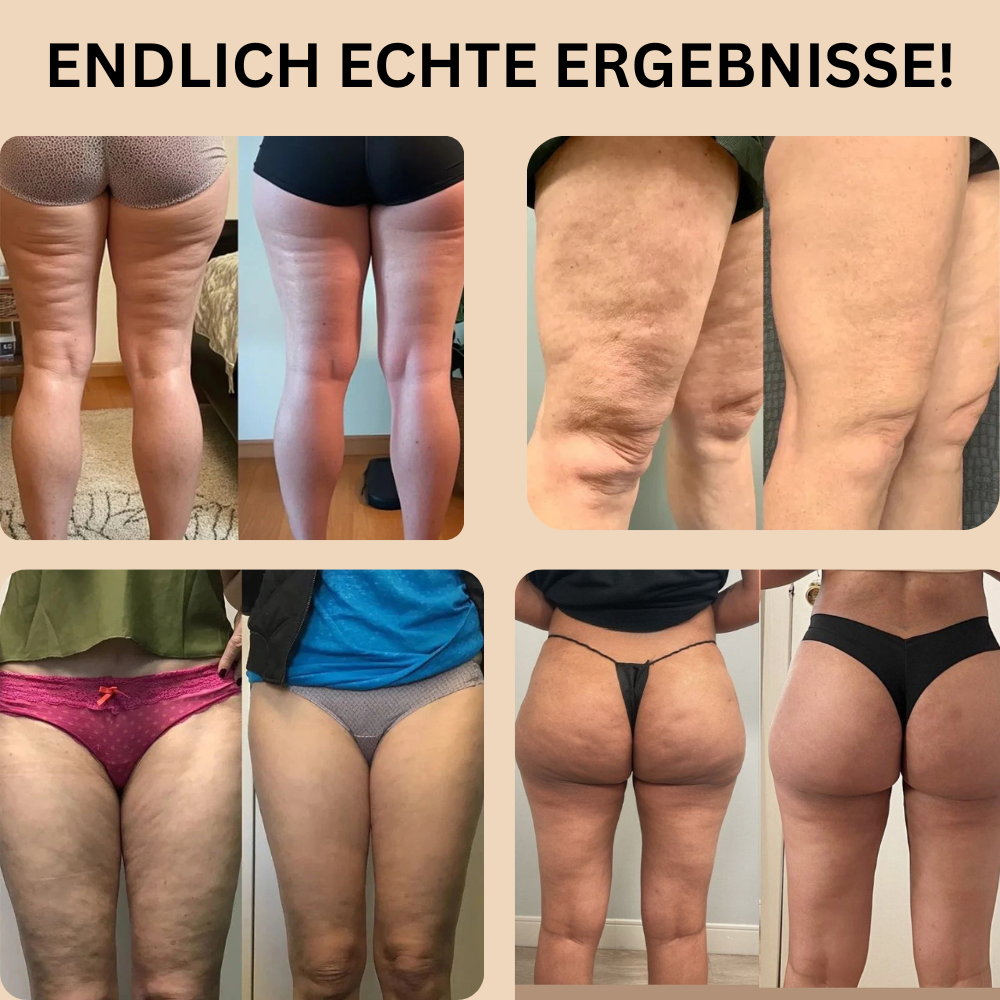 Leggings 3D-Anti-Cellulite skinnyGlow