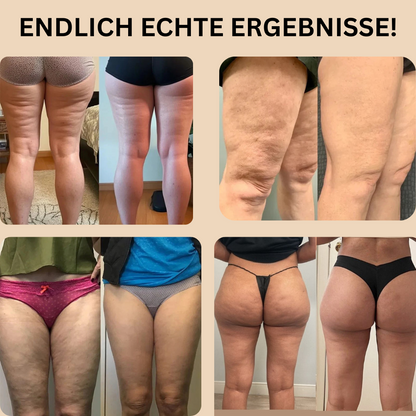 Leggings 3D-Anti-Cellulite skinnyGlow